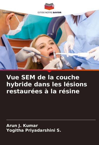 Vue SEM de la couche hybride dans les lésions restaurées à la résine