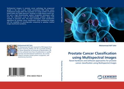 Prostate Cancer Classification using Multispectral Images