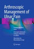 Arthroscopic Management of Ulnar Pain