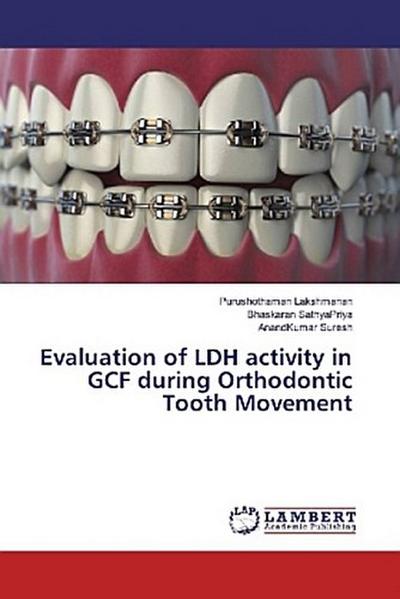 Evaluation of LDH activity in GCF during Orthodontic Tooth Movement