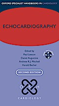 Echocardiography