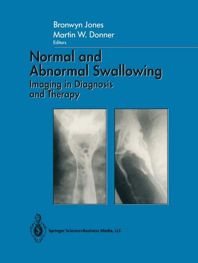 Normal and Abnormal Swallowing