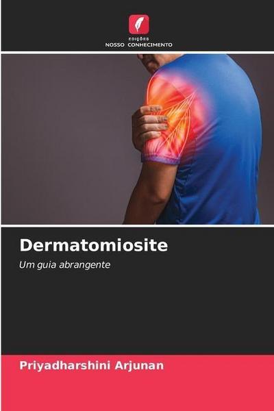 Dermatomiosite