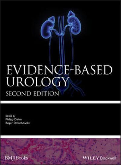 Evidence-Based Urology