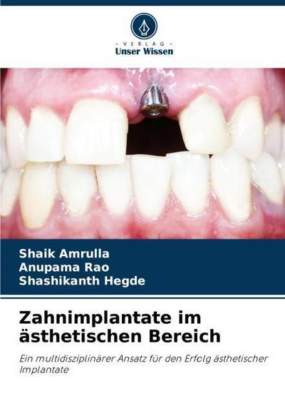 Zahnimplantate im ästhetischen Bereich