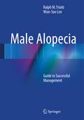 Male Alopecia