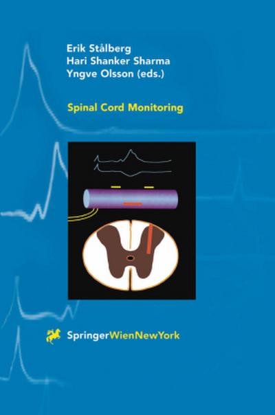 Spinal Cord Monitoring