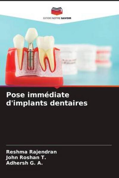Pose immédiate d’implants dentaires