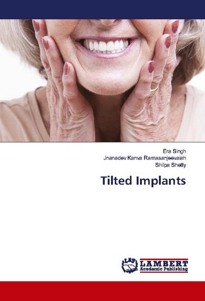 Tilted Implants