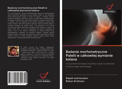 Badanie morfometryczne Patelli w ca¿kowitej wymianie kolana