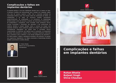 Complicações e falhas em implantes dentários
