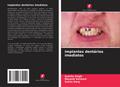 Implantes dentários imediatos