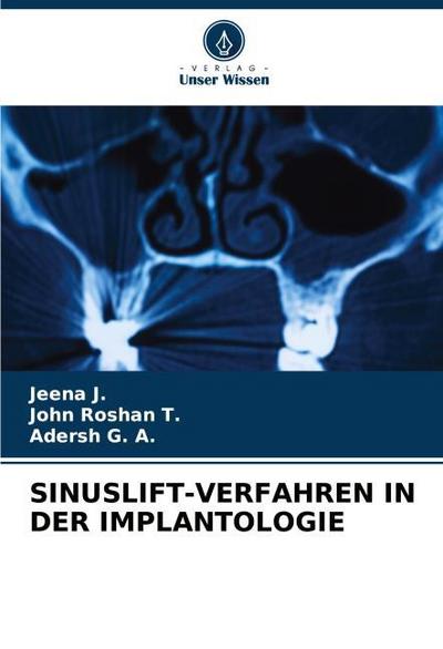 SINUSLIFT-VERFAHREN IN DER IMPLANTOLOGIE