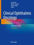 Clinical Ophthalmic Oncology