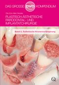 Plastisch-Ästhetische Parodontal- und Implantatchi