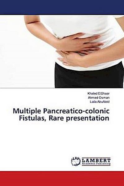 Multiple Pancreatico-colonic Fistulas, Rare presentation