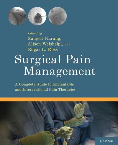 Surgical Pain Management
