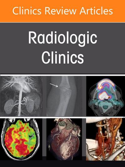 Musculoskeletal Interventional Radiology, an Issue of Radiologic Clinics of North America