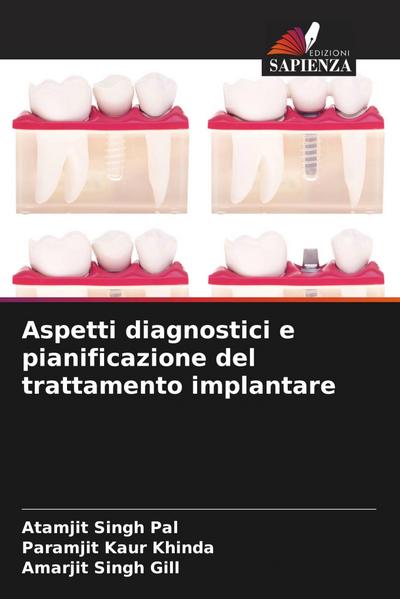 Aspetti diagnostici e pianificazione del trattamento implantare