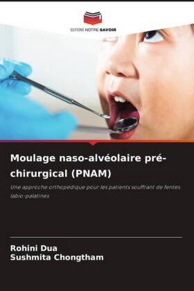 Moulage naso-alvéolaire pré-chirurgical (PNAM)