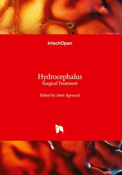 Hydrocephalus - Surgical Treatment