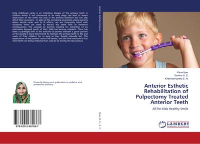 Anterior Esthetic Rehabilitation of Pulpectomy Treated Anterior Teeth