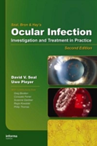 Ocular Infection