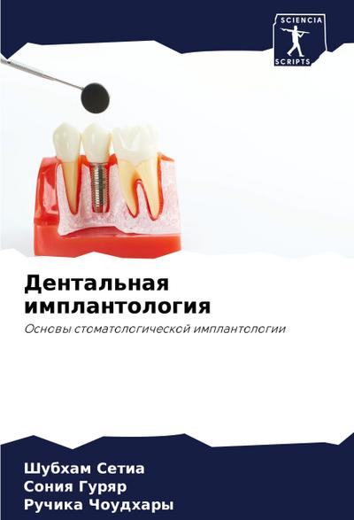 Dental’naq implantologiq