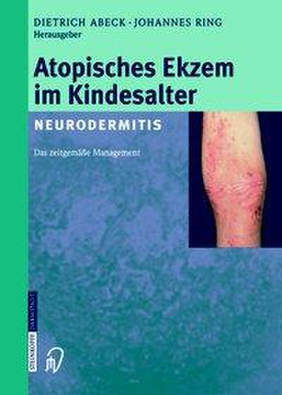 Atopisches Ekzem im Kindesalter (Neurodermitis): ZeitgemÃ¤Ã?es Management D. Abeck Editor