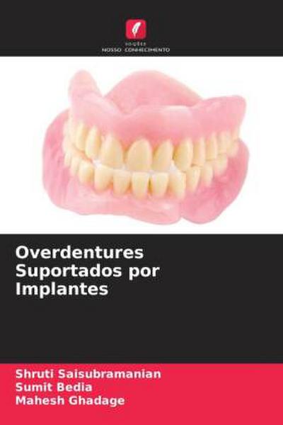 Overdentures Suportados por Implantes