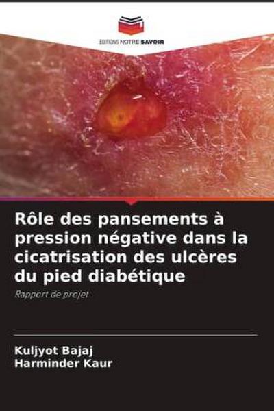 Rôle des pansements à pression négative dans la cicatrisation des ulcères du pied diabétique