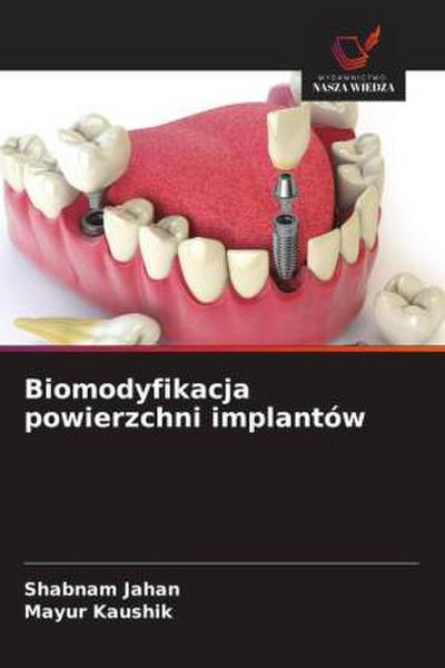 Biomodyfikacja powierzchni implantów