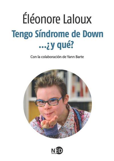 Tengo Síndrome de Down-- ¿y qué?