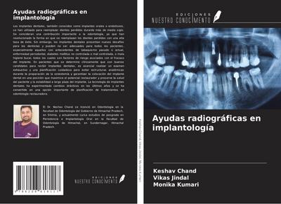 Ayudas radiográficas en implantología