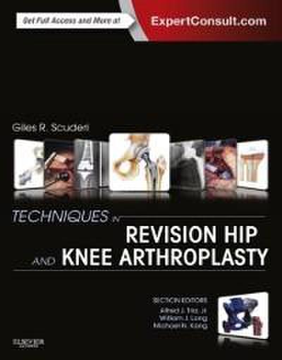Techniques in Revision Hip and Knee Arthroplasty E-Book