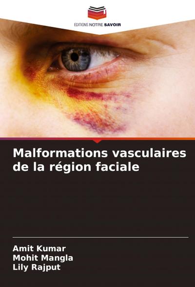 Malformations vasculaires de la région faciale