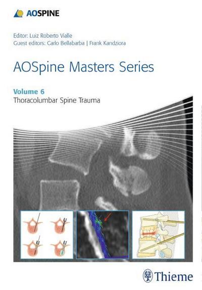 Thoracolumbar Spine Trauma