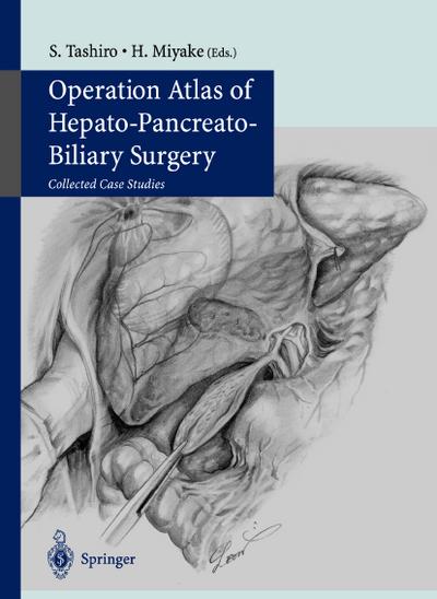 Operation Atlas of Hepato-Pancreato-Biliary Surgery