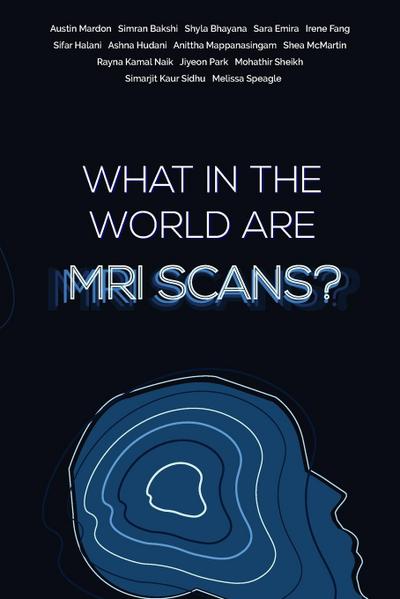 What in the world are MRI Scans?