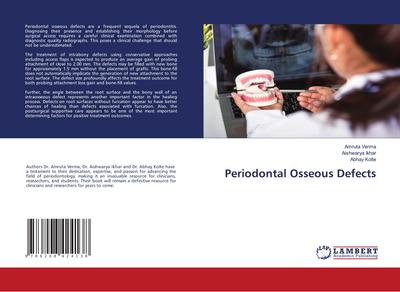 Periodontal Osseous Defects