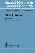 Skin Cancer: Basic Science, Clinical Research and Treatment