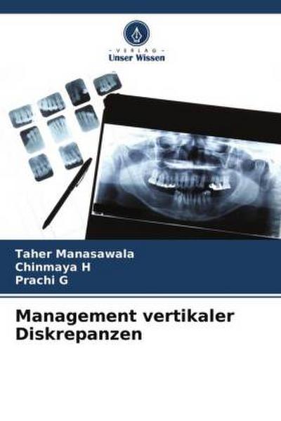 Management vertikaler Diskrepanzen