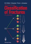 The Comprehensive Classification of Fractures of Long Bones