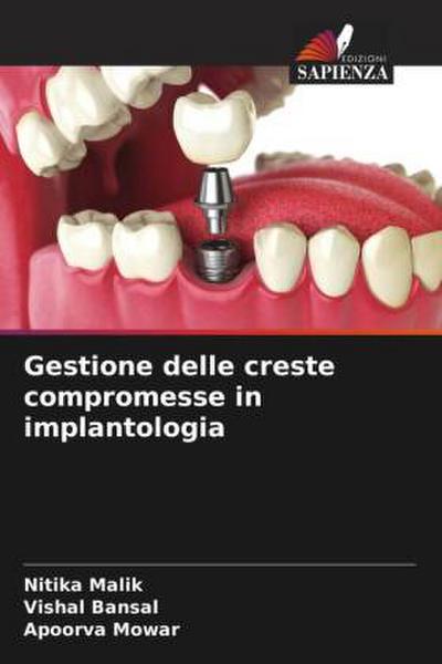 Gestione delle creste compromesse in implantologia
