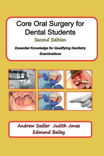 Core Oral Surgery for Dental Students Second Edition