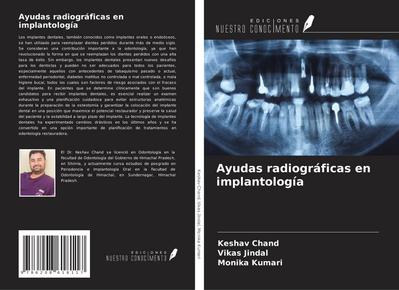 Ayudas radiográficas en implantología