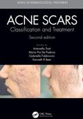 Acne Scars