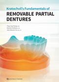 Kratochvil’s Fundamentals of Removable Partial Dentures