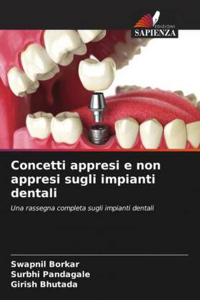 Concetti appresi e non appresi sugli impianti dentali