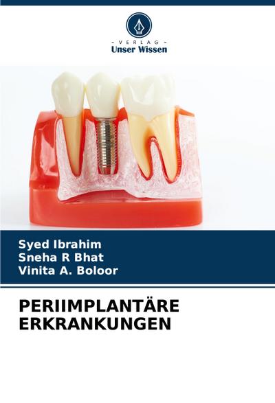 PERIIMPLANTÄRE ERKRANKUNGEN
